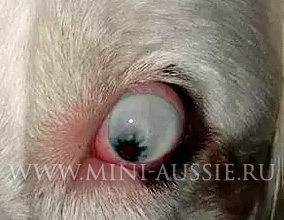 Коракотопия - смещение зрачка