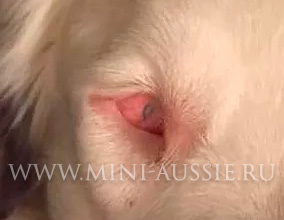 Склерозирующий лишай в Австралии